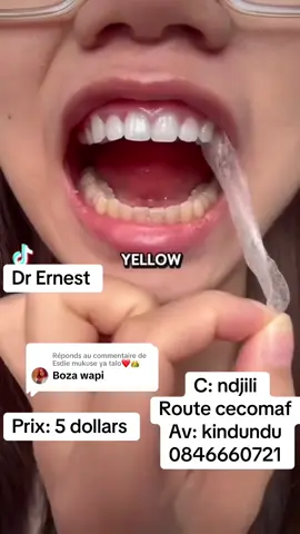 Réponse à @Esdie mukuse ya talo❤️👑 #fypシ゚viral #kinshasa🇨🇩 # @Dr ERNEST  @Dr ERNEST  @Dr ERNEST #@