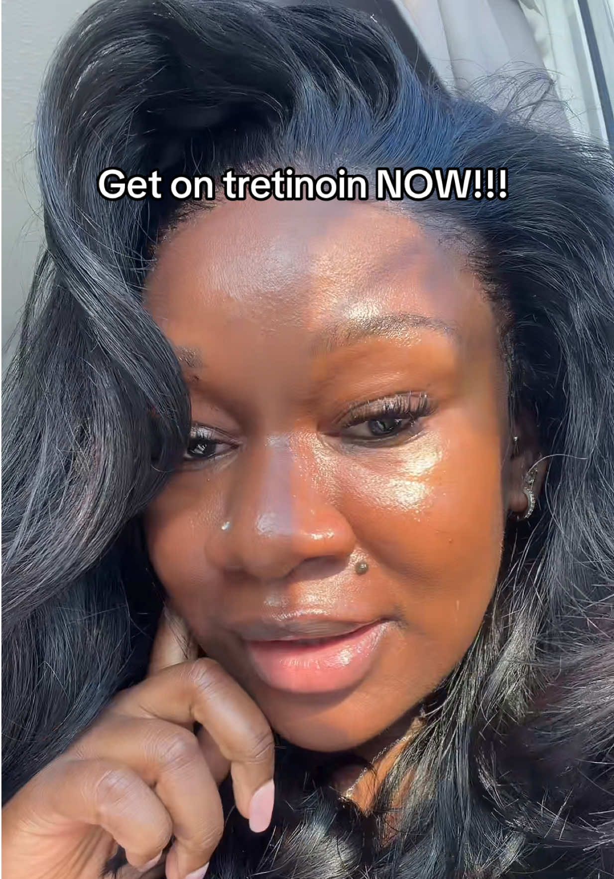 Get on tretinoin and clear your skin I wish someone would have told me this earlier #tretinoin #ClearSkinSecrets 