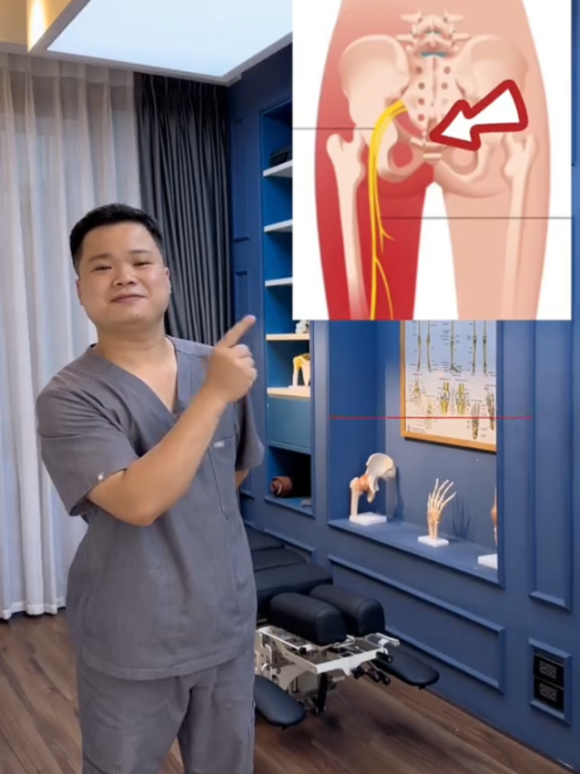 Sciatica pain can cause discomfort that travels from the lower back through the hip and down the leg. Gentle stretching, regular movement, good posture, and simple exercises may help improve flexibility and reduce discomfort. Avoid movements that make the pain worse, and consult a healthcare professional if the pain is severe, persistent, or associated with weakness or numbness. #Sciatica #SciaticaPain #BackPain #LowerBackPain #tiktokgrowth 