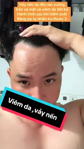 Rồi cũng sẽ ổn thôi các bạn, kiên.trì.và cố gắng ta sẽ kiểm soát ổn.định #nhutuongziaja #xuhuong #viemdatietba #viralvideo #xuhuongtiktok 