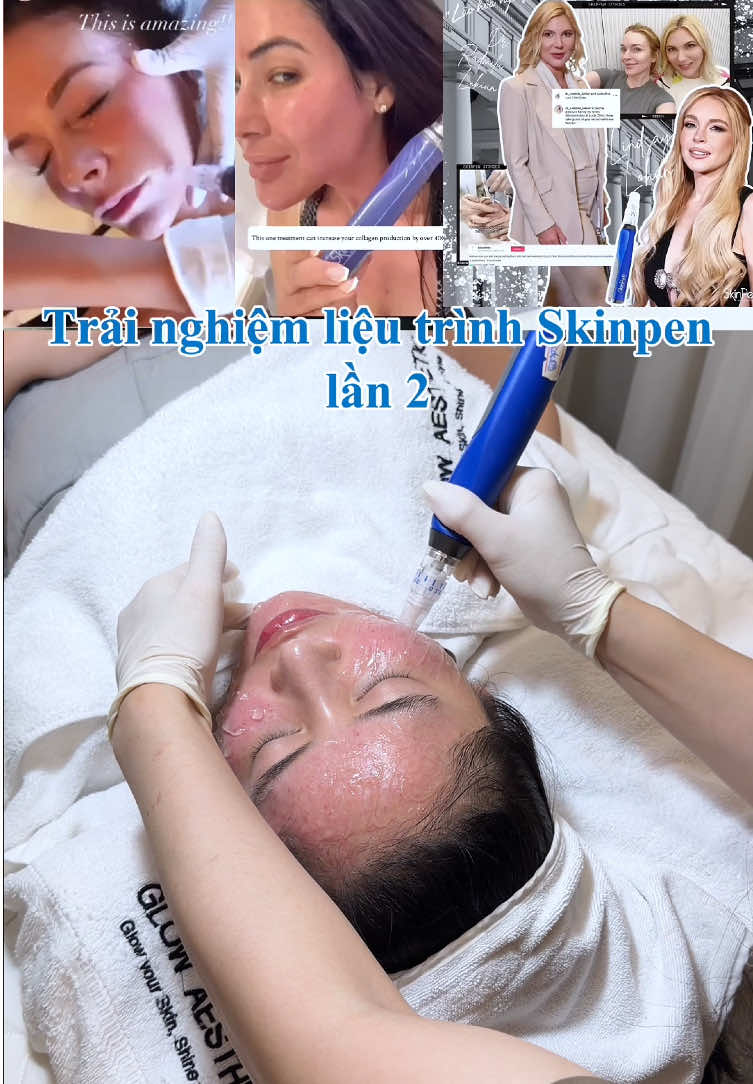 Đi lần 2 là các bác biết tui mê em này như nào rồi đấy 🫣🫣🫣🫣 #kieulanbeauty #skinpen #beauty #goclamdep #viral 