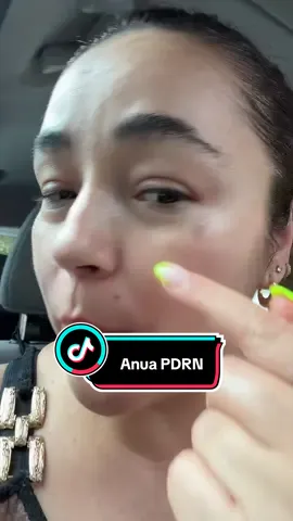 Anua pdrn Disclaimer: Resultados no garantizados. Este producto forma parte de una rutina de cuidado personal y puede variar dependiendo de cada piel. Realiza una prueba en una pequeña área antes de usar. Suspende su uso si presentas irritación. Los resultados pueden variar.#anua #anuaskincare #anuapartner #pdrn #TikTokshopbacktoschool @ANUA Skincare 
