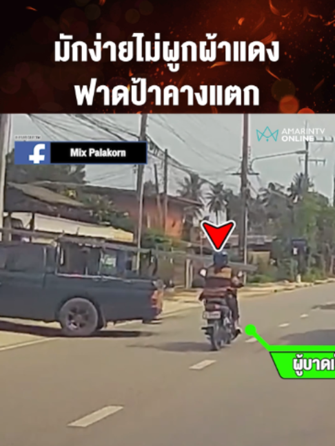 เปิดใจป้าเหยื่อจอดรถมักง่าย เหล็กเส้นโผล่ฟาดคางแตก ล่าสุดเย็บหลายเข็มหมอให้นอนรพ.ดูอาการ ส่วนคู่กรณียอมชดใช้รถ-ค่ารักษา #เหล็กเส้นฟาดคางแตก #อุบัติเหตุ #พิษณุโลก