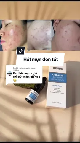 Hết mụn mờ thâm #trimunbenus 