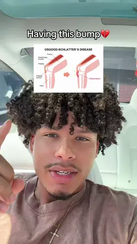 #viral 