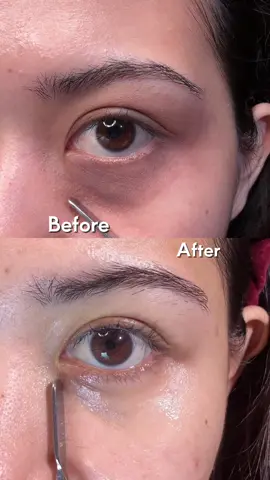 percaya sama prosesnya, yang dulunya bawah mataku gelap sekarang jadi cerah krn pakai eye care gel ini. #eyecare #matapanda #kantungmata #eyecaregelozzaskin #eyecaregel