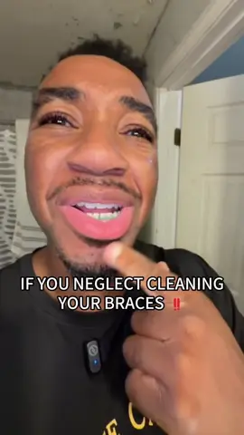 #braces #stainedteeth #bracesoff #ceelike 