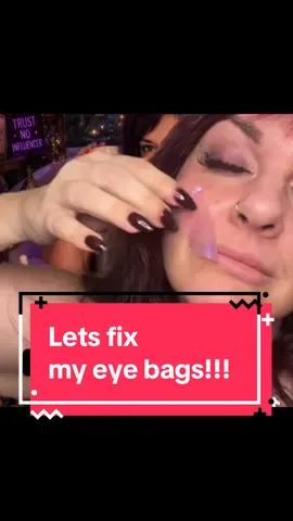 Let’s fix our eye bags!  #retinoleyeliftpatches #undereyebags #undereyecircles 
