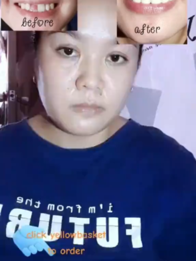 Dikira Pakai Veneer padahal pakai produk ini #tiktokshopindonesia #diskontiktokshopd #fypシ゚viral🖤tiktok #fypviralシviral #fypage #glowing #fypdongggggggggシ #fvpシ♡ #foryou #beauty #Fyp #fyyyyyyyyyyyyyyyy #fypppppppppppppp #fy #glowing #bund #capcut #cantik #gigi