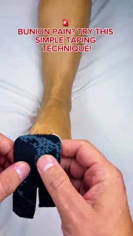 🚨 BUNION PAIN? TRY THIS SIMPLE TAPING TECHNIQUE! Your big toe doesn’t have to feel constantly pulled, tight, and irritated. This easy kinesiology taping technique can provide gentle support around the big toe joint and may help: 🦶 Support better toe positioning ⚡ Reduce stress around the bunion area 🔥 Provide comfort during movement 👣 Support more comfortable walking Easy tape. Gentle support. Happier feet. For comfort and support—not a permanent correction for a bunion. #Bunion #BunionPain #KinesiologyTape #FootPain #FootCare   