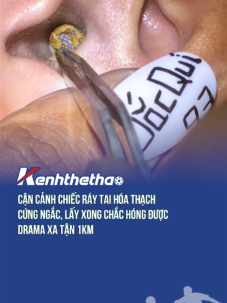 Ui cứng đờ luôn #Btsmedia #blogtamsu #xuhuong #viral #raytai #haihuoc