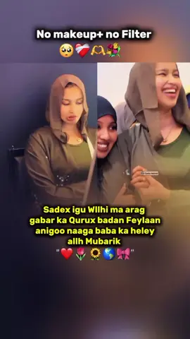 Ovvvvv 💞👀#Mudugwarewgto #puntlander🇸🇱 #viraltiktok #galkacyo #viralfyp 