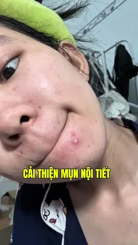 Cách t đã cải thiện mụn nội tiết p1 #damun #munnoitiet #trimun #LearnOnTikTok 