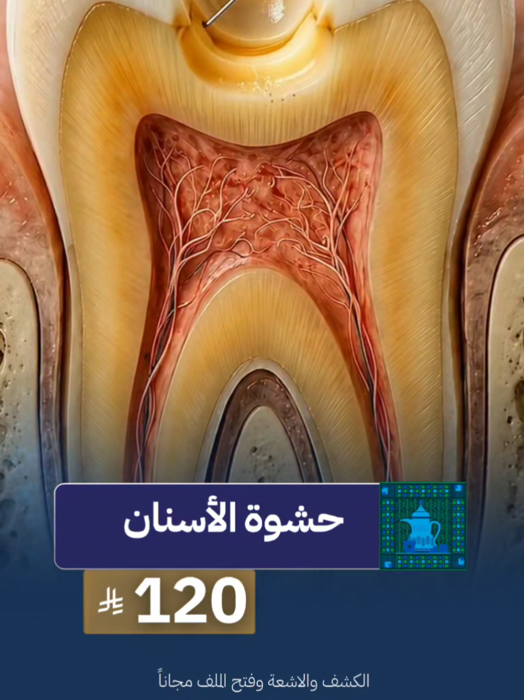 حشوة الأسنان ب 120 ربال فقط  بمناسبة اليوم الوطني في جميع فروعنا في جدة  كير برو كيلينك مكانك الاول لخدمات الاسنان  ارفع الشاشة واحجز موعدك الحين #تركيبات_أسنان #تقويم_الاسنان #ابتسامة_هوليود #زراعة_اسنان #جدة_الان 