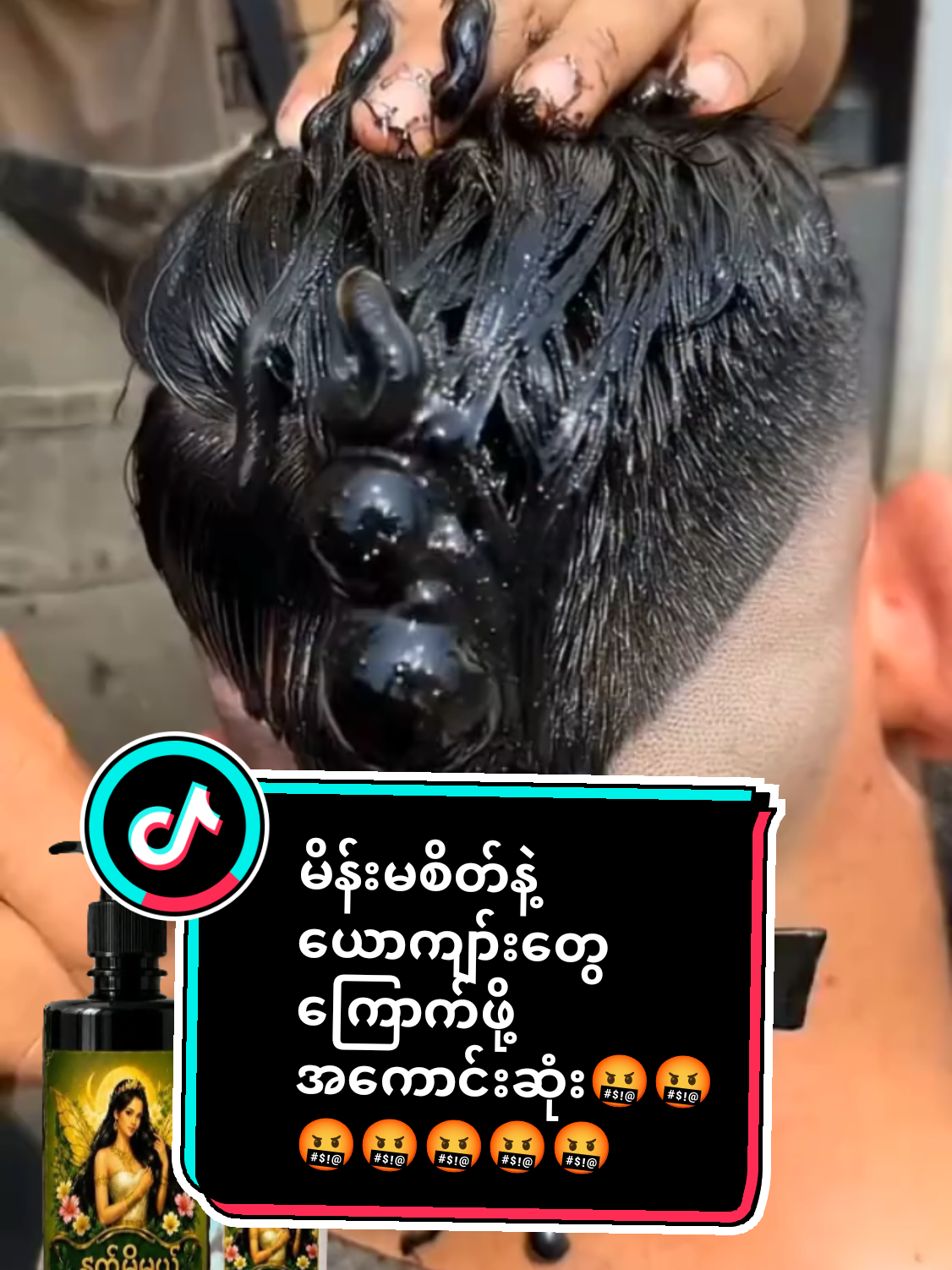 အုံထူအရှည်မြန်တာကြိုက်မှသုံးပေးပါ#ဆံပင်ပြသနာရှိသူတိုင်းကြည့်ပေးပါ #ဆံပင်ကျွတ်သက်သာပီးအုံထူစေဖို့ #ဆံပင်ရှည်ရှည်လေးနဲ့😍😍 #fypシ゚viral #foryou 