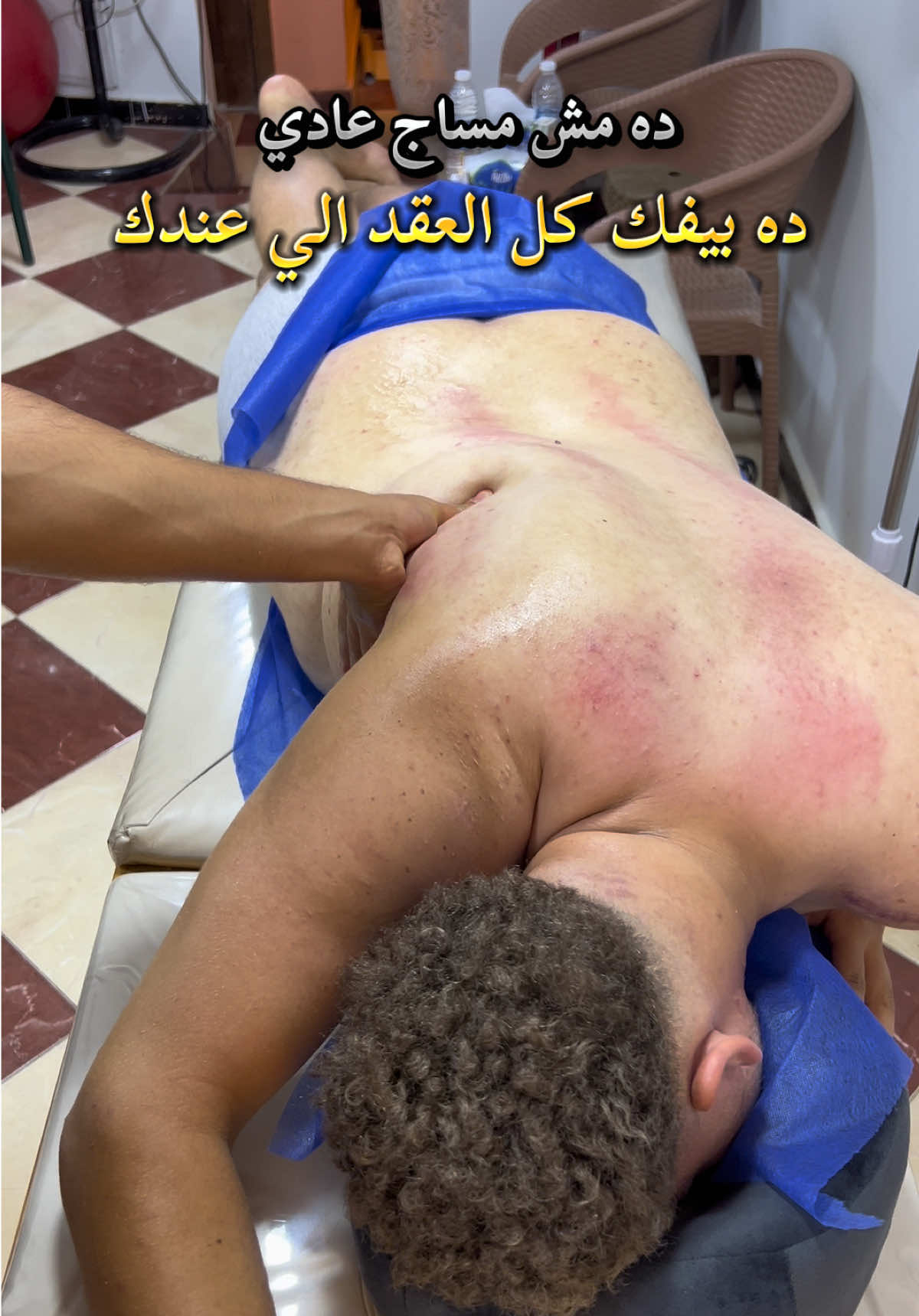 عقد عضليه #مركز_الشفاء_لتاهيل_الاصابات #مركز_الشفاء_للحجامة #تدليك #مساج #حجامه 