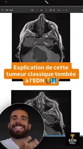 🩻 Commente « RADIO » si tu veux progresser en radiologie ✅ Commente « QCM » pour découvrir gratuitement la plateforme tout en 1 pour préparer l’EDN
