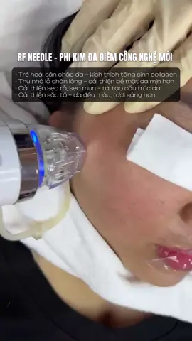 RF NEEDLE – CÔNG NGHỆ PHI KIM ĐA ĐIỂM ✨ Săn chắc da – làm mịn lỗ chân lông – cải thiện sẹo rỗ – hỗ trợ đều màu da 💗 #rfneedle #rf #xuhuong #elanaspa #viral. 