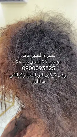 #كسلا_بورتسودان_قضارف #عطبره_بلد_الحديد_والنار #تركيب_شعر #كلبسات_شعر_طبيعي #القوات_المسلحة_السودانية🦅🇸🇩🦅 
