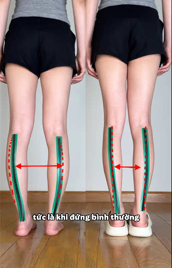 Đi bình thường thôi mà nhìn dáng có vẻ gọn hơn. #archsupport #footcare #reviewthat #tiktokshop #xuhuong 