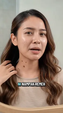Kalau ada benda kecil kat kulit yang buat rasa tak selesa, jangan terus cuba macam-macam cara sendiri 👀 Kenal pasti dulu keadaan kulit dan pilih cara penjagaan yang sesuai. Dermaxa merupakan pilihan ikhtiar dari rumah — gunakan mengikut arahan yang disediakan. ✨ Hasil & reaksi kulit boleh berbeza bagi setiap individu. Kandungan AI ini adalah ilustrasi kreatif untuk tujuan penerangan. #Dermaxa #PenjagaanKulit #SkinCareMalaysia #creatorsearchinsights #SkinTag 