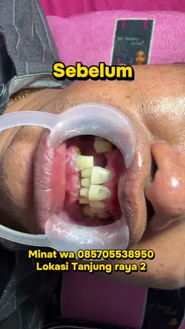 #funkotpontianak🚀_fypp🔥 #funkotpontianak🔥 #funkotpontianak🚀😎 #implangigipontianak #pontianakviral 