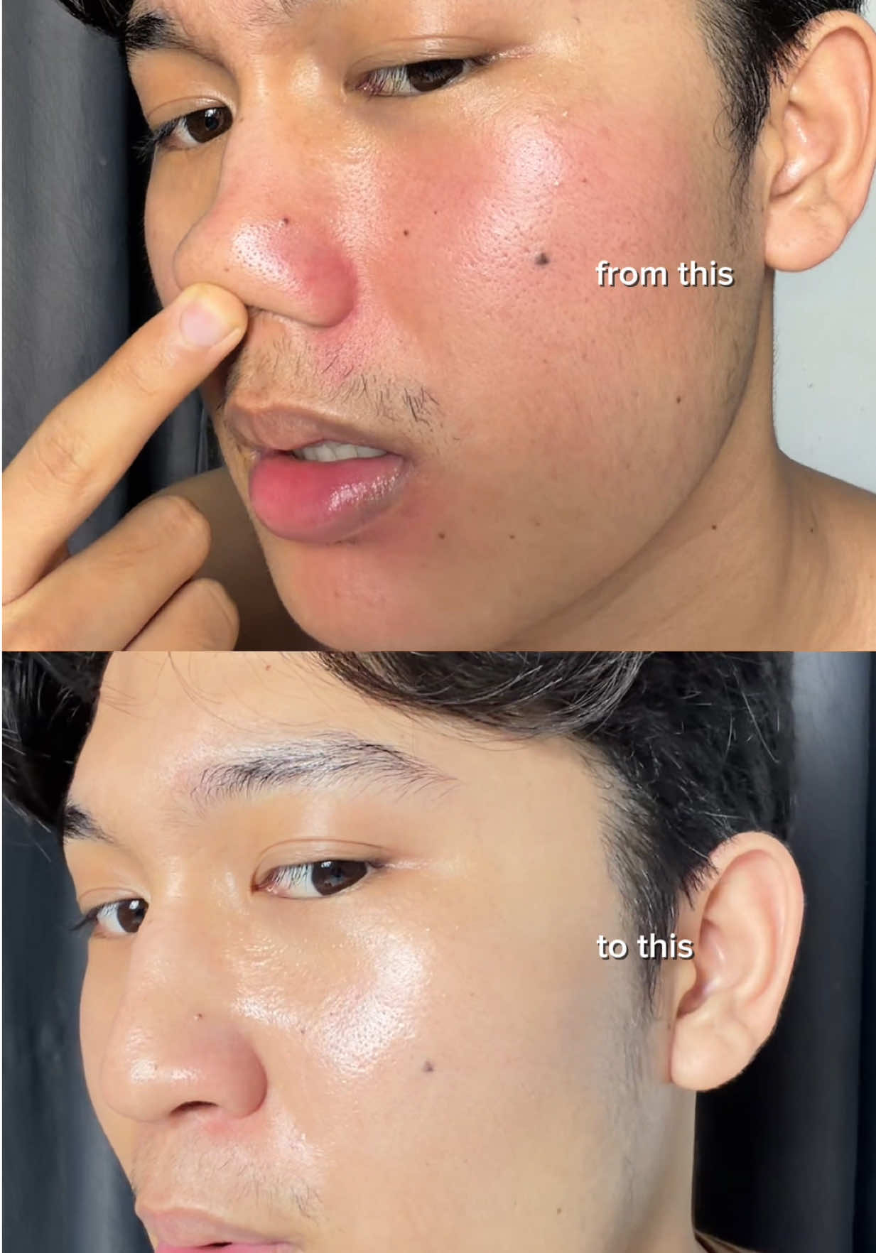 kulit ga rewel lagii huhu🫶🏻  #bening #b5moist #skincareexpert #lumixpert #racikanxpert 