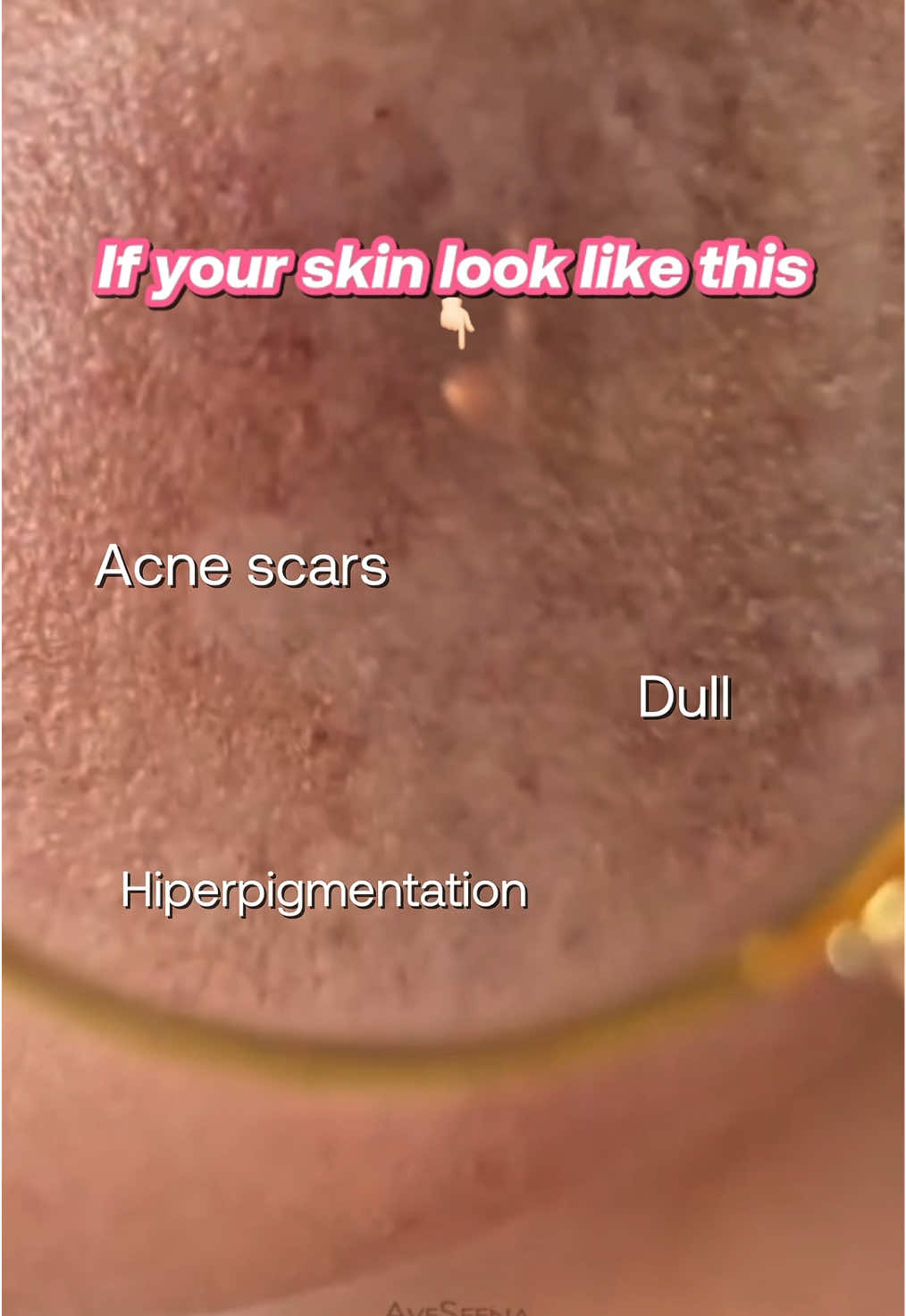 Fokus ke skin concern, so choose your serum!!🤍 #laboreskinexpert #laboreskincare #svs