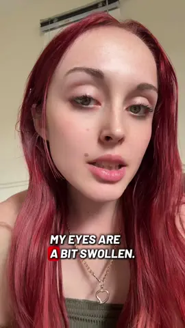 #fyp 