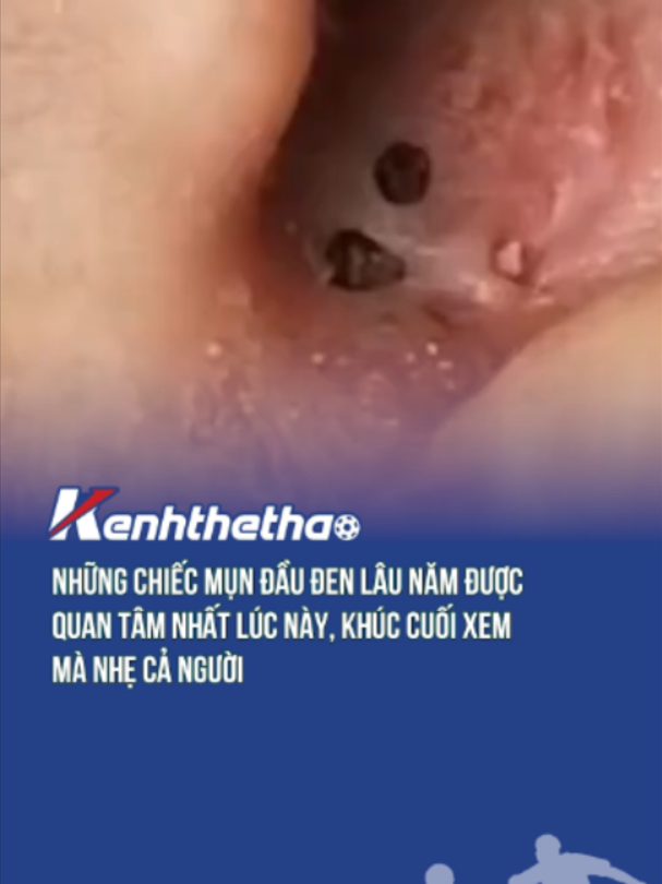 Biết chỗ mọc thiệt chứ #Btsmedia #eyeplusmedia #xuhuong #viral #haihuoc #funny #nanmun #kenhthethaovn