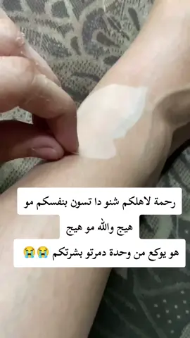 بنات والله هو يوكع من وحدة بس اصبرو كم يوم #تطويل_الشعر_علاج_تساقط_الشعر #تفتيح #ليزر_ازالة_شعر #تصبغات #CapCut 