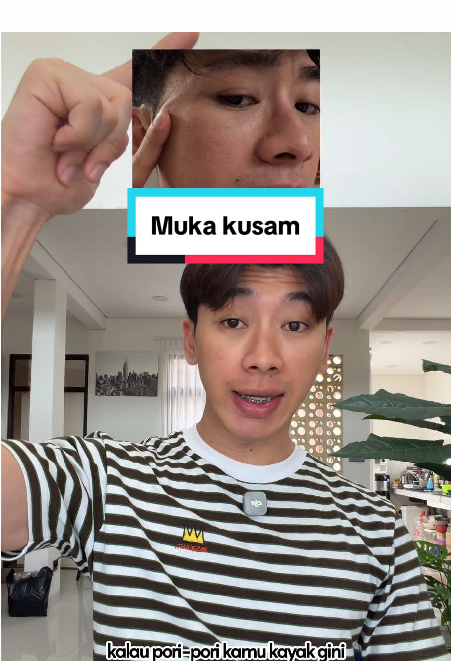 Muka harus dirawat coy #brighteningserum #niacinamideserum #serumpencerah #Glowingskin