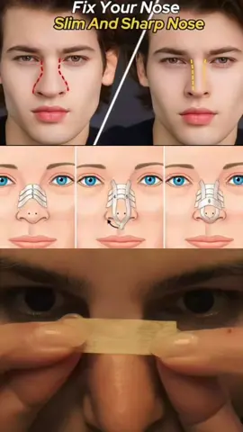 nose taping tutorial  #nosetaping #beautyhack #looksmax #GlowUp #SelfImprovement 
