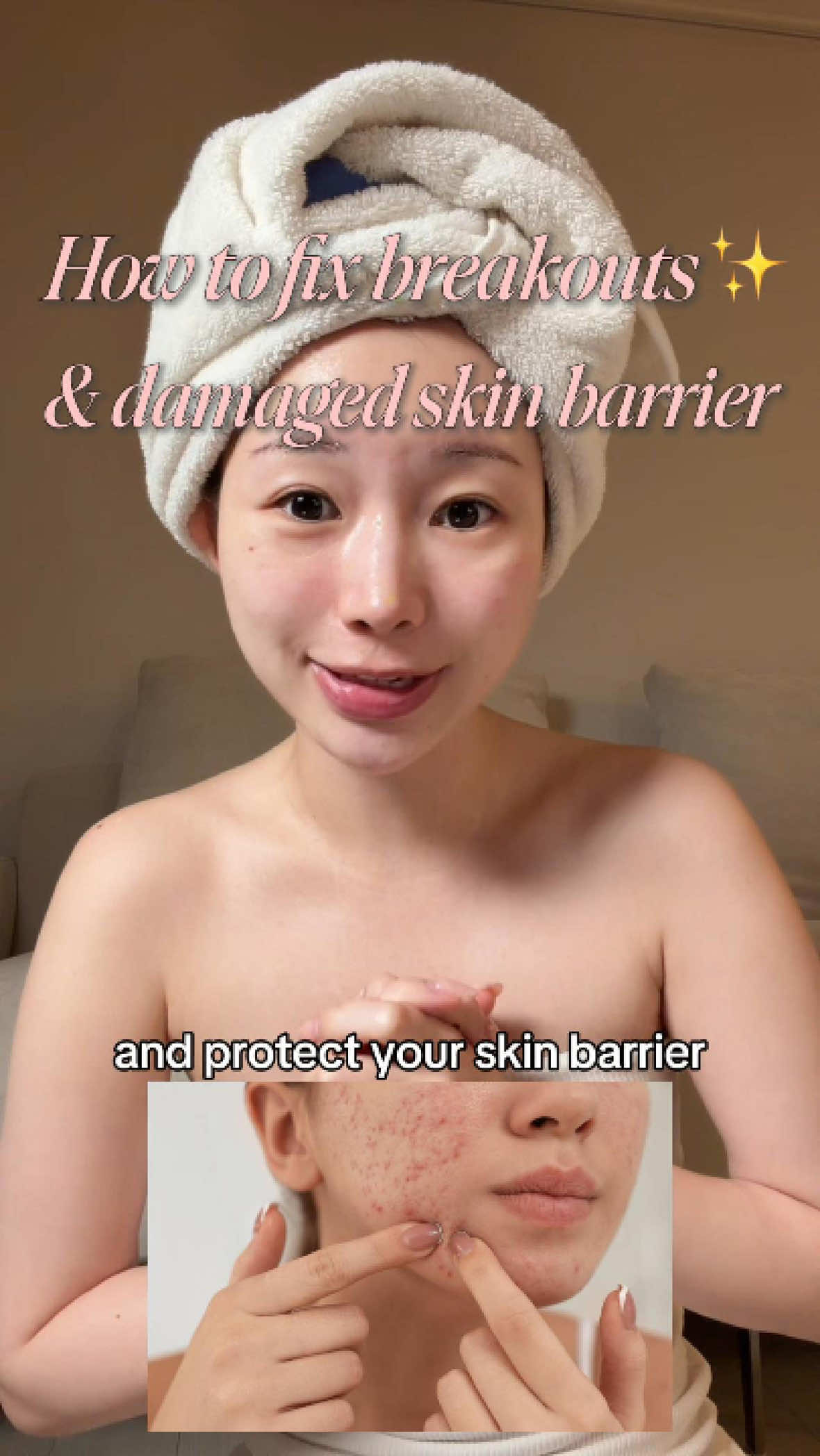 How to fix breakouts & damaged skin barrier  #drleocicamoisturizer #centella #moisturizer #skincare This is partnered with @Dr.Leo-USA 