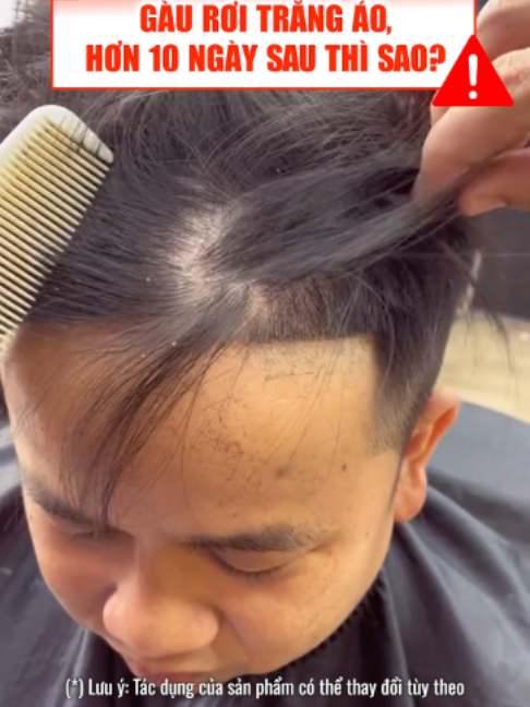 Gàu rơi trắng áo, gàu dày cộp thành sạch thoáng sau thời gian ngắn chỉ với chai dầu gội Antisol Plus này #icarepharma #daugoithaoduoc #viemdatietba #namdadau #xuhuong #trendingvideo #antisol #trigau #salevuifreeship