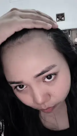 Kalo udh rontok udh pasti krna jarang pake hair tonic gamau lg skip hair tonic🥹💔 #hairtonic #rontok 
