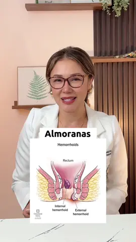 Nakaka-almuranas daw ang pagkain ng maanghang? Myth or fact? 🤔🌶 #hemorrhoids #almoranas #bowelproblems #health #fyp 