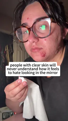 It’s not just acne… it affects how you feel every single day.  #acne #acneskin #acnefighter #acnejourney #acnepositivity