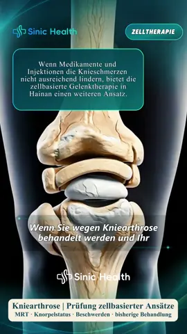 Kniearthrose? So läuft eine medizinische Fallprüfung vor einer Beratung zu zellbasierten Ansätzen in China ab.#medizintourismus #kniearthrose #knie #orthopaedie #mrt 