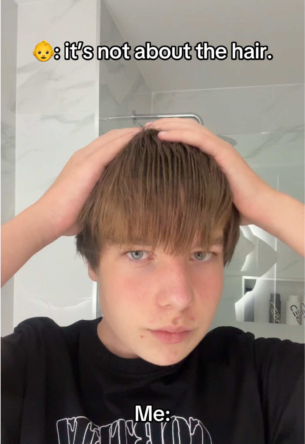 Are you sure? 😉 @Scalp Armor @BASED #hairtok #lowdensity #balding #hairtok #hairtransformation 
