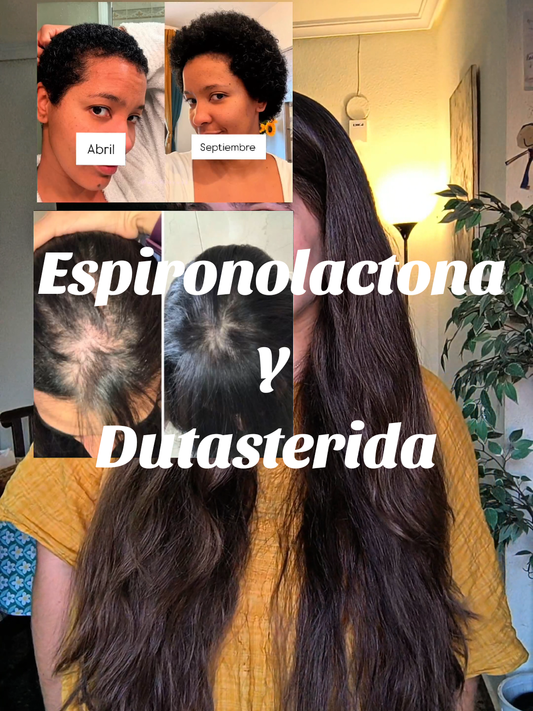 Si existen alternativas seguras, con evidencia científica e igual de eficaces, hay que darlas a conocer ¿no? Escribe AYUDA para una asesoría GRATIS ✨🌸 #hairgrowthjourney #minoxidil #dutasterida #espironolactona #hairfallsolution  @María ✨| Hair Growth 