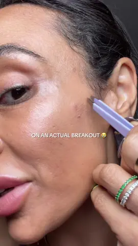 Name a better pimple patch… I’ll wait 👀