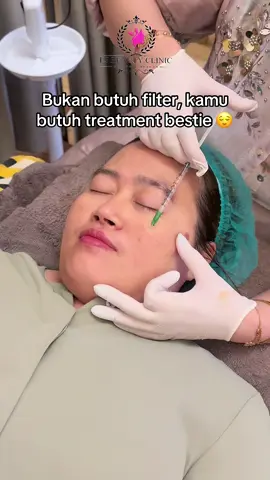 Book your appointment now dan  langsung treatment di Fs Beauty Clinic💙✨ thank you sudah mempercayakan tindakany di @fs_beautyclinic_ ❤️❤️❤️🥰 Semakin glowing & fresh dibulan September 2026 ini ya!! 🥰 See you at Fs Beauty Clinic✨💙 More info: 📲 088287023397 📍Jl.panglima Polim no. 24 segala mider, bandar Lampung  #fsbeautyclinic #klinikkecantikan #fsbeautyclinic #klinikkecantikanfsbeautyclinic #tanambenanghidung                