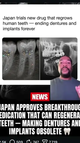 No whitening strips needed!Just a good toothpaste that makes your teeth white using niacinamidel🦷✨#teethcare #teethwhitening #toothpaste #oralhealth #niacinamide 