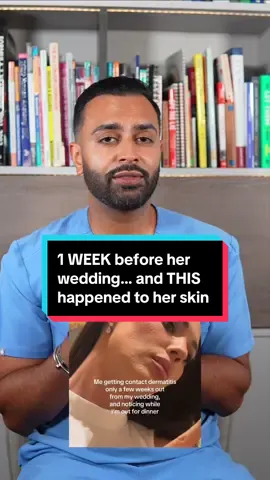 She thinks it’s contact dermatitis, but from what I can see, I’m not convinced that’s actually what’s going on 👀 If it was contact dermatitis, the priority would be to strip things back, avoid potential triggers and focus on calming the skin rather than throwing more products at it. And one week before a wedding is definitely not the time to start experimenting with new skincare. #ContactDermatitis #SkinReaction #SkinDoctor #WeddingSkincare #Dermatology 