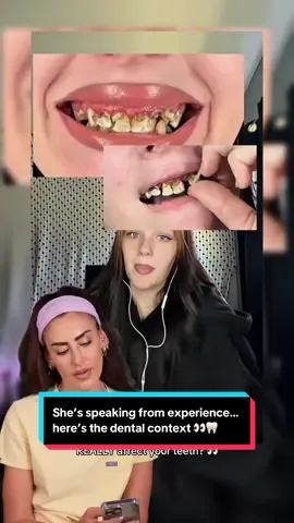 I really appreciate her speaking so openly about her own experience with her teeth. Conversations like this can help so many people feel less alone. 🤍 Genetics can play a role in our dental health, but it’s only one piece of a much bigger picture. Things like enamel, saliva, diet, acid exposure, oral hygiene, medications and individual circumstances can all influence what happens to our teeth over time. And where there has been repeated exposure to stomach acid, that can also contribute to significant tooth erosion. Every person and every smile is different, so this isn’t about saying anyone’s experience is right or wrong. I just wanted to add the dental perspective alongside someone sharing her lived experience so openly. 🦷 #DentalHealth #DentistExplains #ToothErosion #OralHealth #DentalEducation 