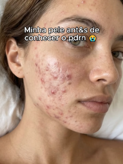 #skincare #foryou