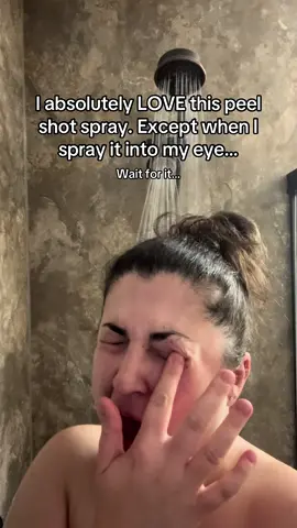 Owwwww…. At least my skin is soft 😭😭 #drmelaxin #peelshot #skincare #fail #securepayeveryday 