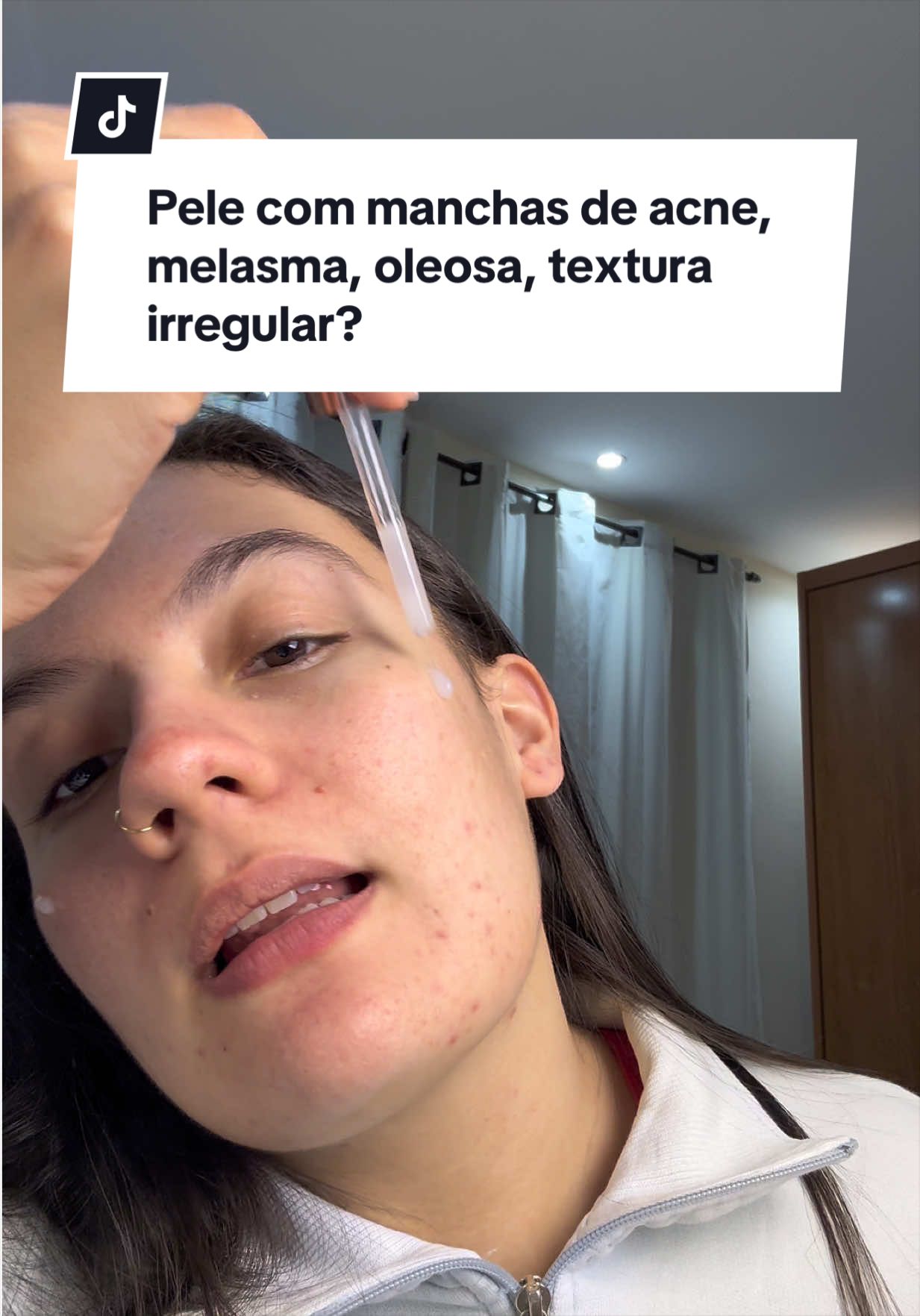O serum perfeito para peles manchadinhas 😍 #clareador #acidotranexamico #peleoleosa #zencial #tiktokshopbr 