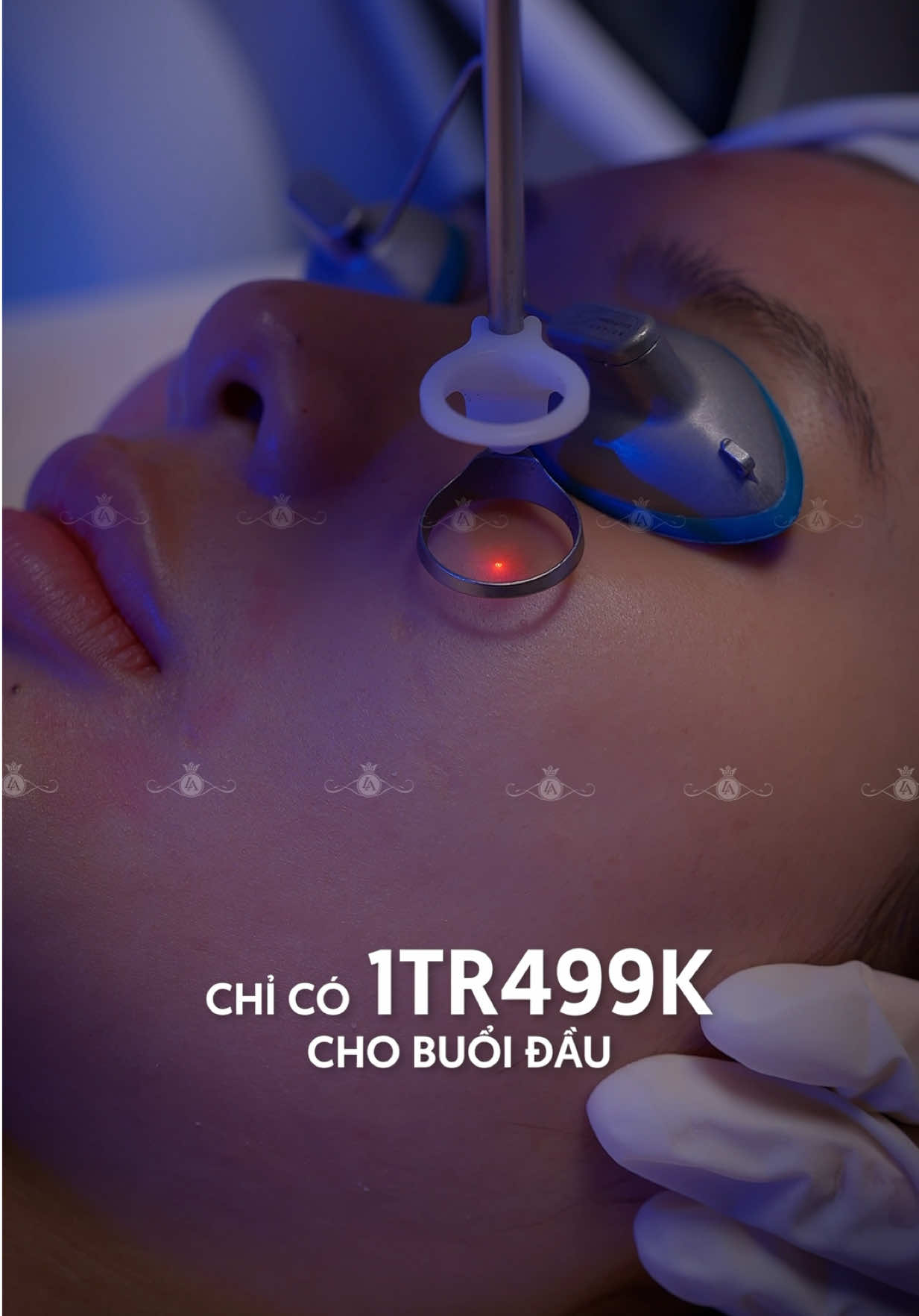 LASER FOTONA - Cải thiện da đa tầng. ĐẶC QUYỀN TRẢI NGHIỆM: Ưu đãi từ 5 TRIỆU GIẢM CÒN 1.499.000 VNĐ/ buổi đầu. Nhắn tin đăng ký sớm tại đây#tmvlinhanh #thammylinhanh #laser #trehoada #laserfotona 